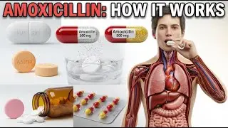 How Amoxicillin Works Inside the Body | 3D Medical Animation