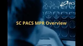 How to Use MPR in SC PACS | Step-by-Step Tutorial for Radiologists & Clinicians