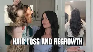 HAIR LOSS AND REGROWTH! What I think happened and how I grew it back! 