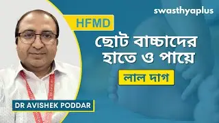 শিশুদের হাত, পা এবং মুখের রোগ | What is Hand, Foot & Mouth Disease? in Bangla | Dr Avishek Poddar