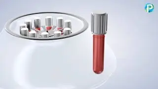 Platelet-Rich Growth Factors in Roseville CA | Placer Oral & Dental Implant Surgery