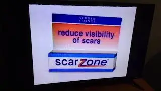 ScarZone TV Commercial (June 2005)
