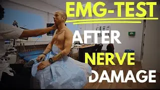EMG TEST: NERVE AFTER SHOULDER SURGERY