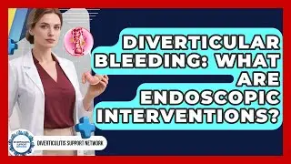 Diverticular Bleeding: What Are Endoscopic Interventions? - Diverticulitis Support Network
