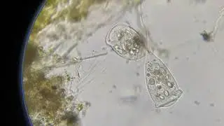 Vorticella sp. en proceso de mitosis (divisi&oacute;n celular)