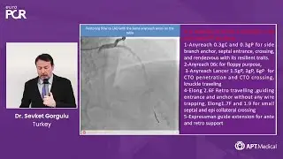 Is it feasible to tie a CTO procedure with only Anyreach wire family? - Dr. Sevket Gorgulu | EuroPCR