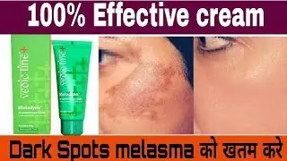🔥 Vedicline Meladyne De Pigmentation cream & Skin pigmentation, Hyper Pigmentation, skin Discolor