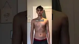 Crazy Teen Body Transformation #fitness #bodybuilding