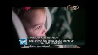 Health News: Eye-tracking trial seeks signs of autism in babies