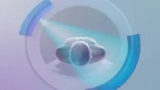 CT Scan