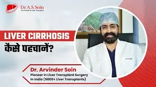 Liver Cirrhosis कैसे पहचानें? Symptoms, Tests & Diagnosis | Dr. A.S Soin