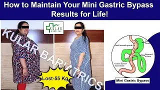How to Maintain Your Mini Gastric Bypass Results for Life! @kskular
