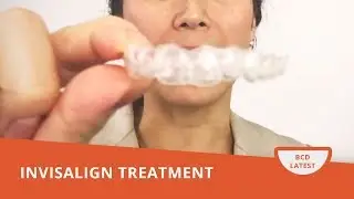 What Is Invisalign? Watch This Video.