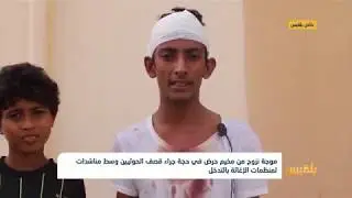 تسعة شهداء وعشرات الجرحى في قصف للحوثيين استهدف مخيما للنازحين في حرض بحجة|تقرير: أمين صالح