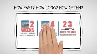 Botox FAQs | Botox in San Francisco