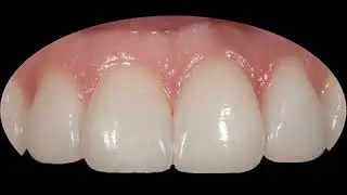 Best Dentist In Beverly Hills | DR. RODNEY RAANAN DDS MMSc