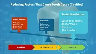 An Educational Approach to Cavity Prevention