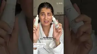 Real Skin Journey with Amiy Acne SOS | Natural Remedy That Cleared Acne from Within 🌿
