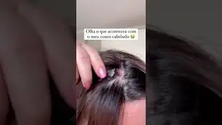 Descama&ccedil;&atilde;o do couro cabeludo #progressiva #courocabeludo #caspa #descama&ccedil;&atilde;o #oleodecoco #cabelo