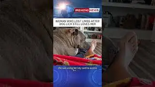 WOMAN WHO LOST LIMBS AFTERDOG LICK STILL LOVES HER #foryou #news