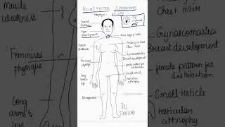 Klinefelter syndrome - Genetic disorder #medical #neetpg #education #genetics #mbbs #revision