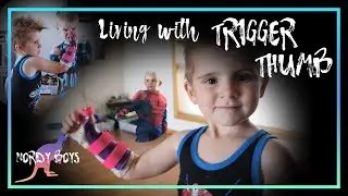 PEADIATRIC TRIGGER THUMB - How Spartan copes with his new Super Powers