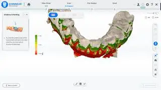 Aoralscan - Undercut Checking