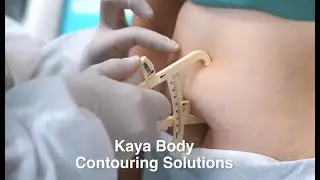 Sculpt your Body by Freezing Fat with Kaya Coolsculpt