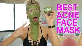 Detox Face Mask KILLS Pimples