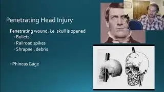 Traumatic Brain Injury (Stroke, TBI, & Aphasia Part 2)