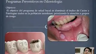 Programas de Salud Dental