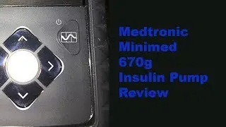 Medtronic MiniMed 670g Insulin Pump Review So Far
