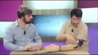 Hillarious Robot Arm Malfunction!