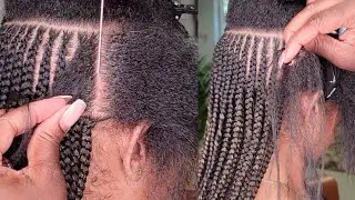 PERFECT FEED IN BRAIDS