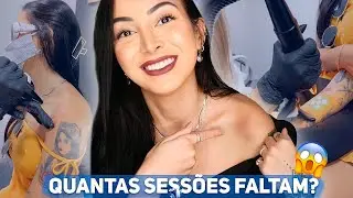 COMO ANDA A REMOÇÃO DA MINHA TATUAGEM - ATUALIZAÇÃO
