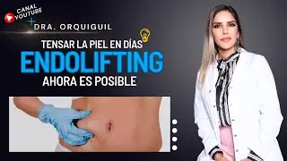 ENDOLIFTING. Todo lo que tenes que saber y las zonas que podes tratar con este procedimiento.