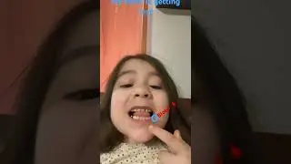 #lostteeth