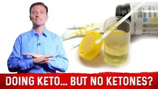 In Ketosis But No Ketones In Urine? &ndash; Dr. Berg