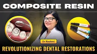 Modern Dental Fillings with Composite Resin 🦷 | Classifications & Composition | Dr. Rashmi Explains
