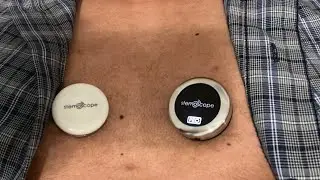 Stemoscope vs Stemoscope PRO