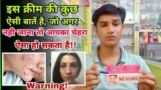no scars cream use karne ka tarika | no scars cream review by doctor