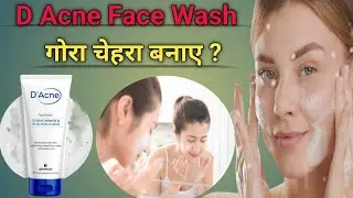 D Acne Face Wash | D Acne Face Wash Review | Oil Control Face Wash | D Acne Face Wash Benefits 