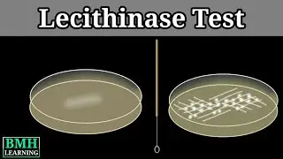 Lecithinase Test | Nagler's Reaction | Clostridium Testing Method | Test For Clostridium Perfirenges