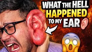 What The Hell Happened To My Ear😨 #vlog4