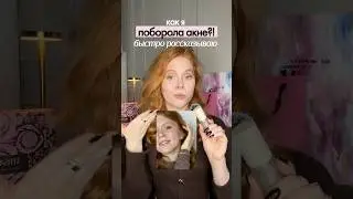 КАК Я ПОБОРОЛА АКНЕ? 💅🏻 tg: cathrinova
