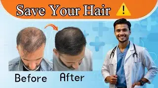 Hair Fall : Causes, Early Signs & Provem Solutions 