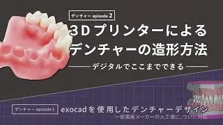 3Dプリンターによるデンチャーとテックの造形方法 『フルデジタルデンチャー』の作成が実現！
