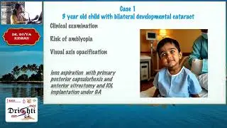 KSOS 2025   IC71   T Dr Divya Kishan The &lsquo;white reflex&rsquo;unravelled  congenital cataract and more