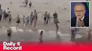 Bondi Beach terrorist attack: Injured gunman likely to survive, police say