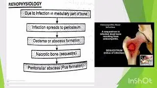 3rd lecture bone disease osteomyelitis #nursing management #pathophysiology# cause symptoms #youtube
